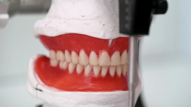 Jaw tooth model in dental clinic
