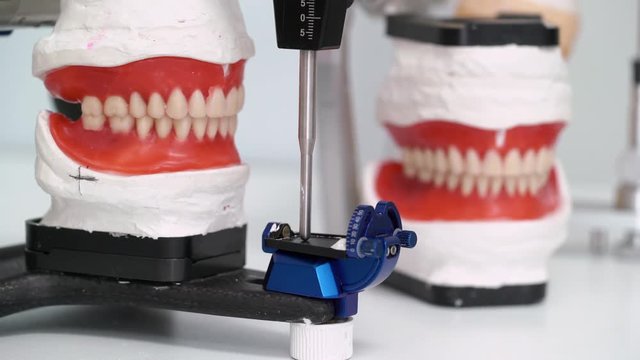 Jaw tooth model in dental clinic