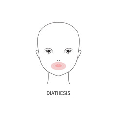 Diathesis in baby