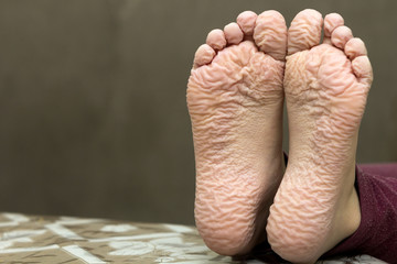Close-up of children wrinkled feet after long bath