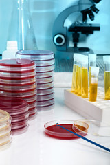working table of a microbiology laboratory with samples and test plates / test plates and equipment for microbiology analysis