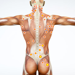 Vista di spalle di una persona, muscoli della schiena con i trigger points evidenziati. Anatomia e corpo umano - obrazy, fototapety, plakaty
