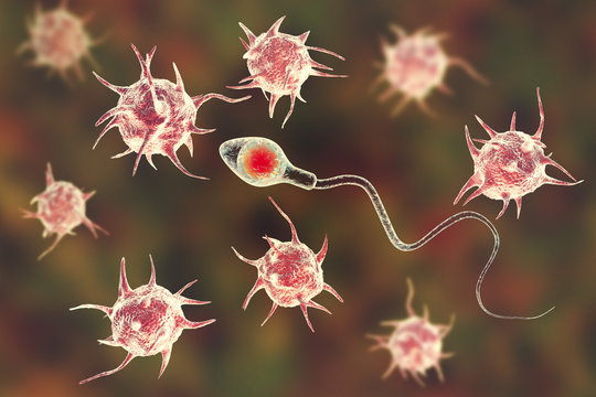 Infertility concept, microbes attacking spermatozoon and preventing it from fertilization, 3D illustration