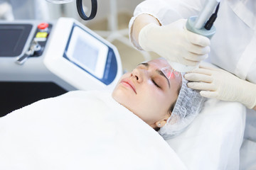 Beauty procedure. Professional beautician making facial peeling in a forehead. Laser face peeling.