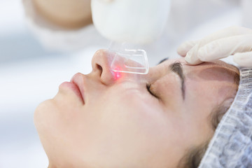 close up professional beautician making facial peeling on a nose. Laser face peeling.