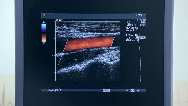 Ultrasound machine with monitor. Examination of the heart
