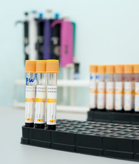 test tubes with blood on tray