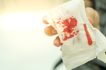 Blood on gauze use to stop bleeding