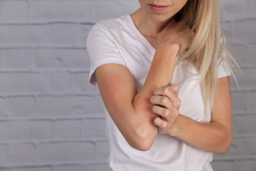 Woman Scratching an itch . Sensitive Skin, Food allergy symptoms, Irritation - obrazy, fototapety, plakaty
