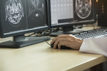 Doctor looking at MRI in computer monitor