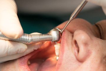 A dentist makes teeth to a woman