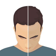 Close up vector portrait of a man before and after cosmetic procedure. Beauty facial injections for men. Anti-ageing therapy for facelift and wrinkles. Male rejuvenation treatment infographics. 