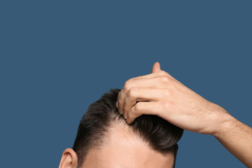Young man with hair loss problem on color background