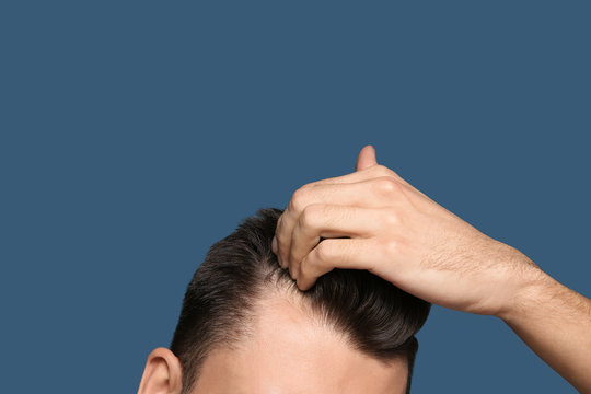 Young man with hair loss problem on color background