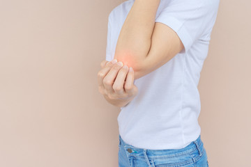 Woman scratching her elbow.