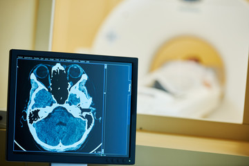 MRI scan test or computed tomography. Display with brain x-ray image