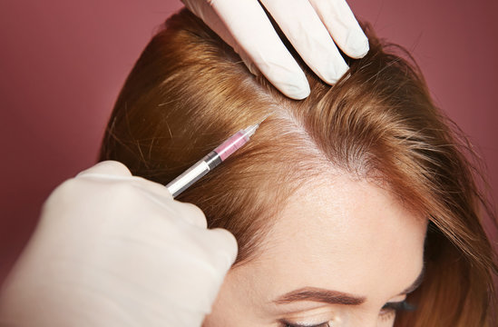Young woman with hair loss problem receiving injection, on color background