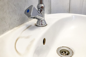 Waschbecken mit Verschmutzungen 