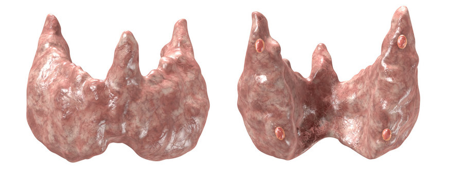 Thyroid gland, front and back view with parathyroid, realistic medical illustration