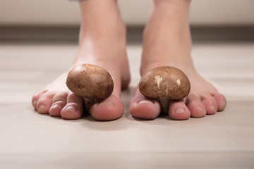 Mushrooms Between Woman's Toes