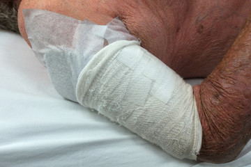 Bandaged arm wound on a senior man