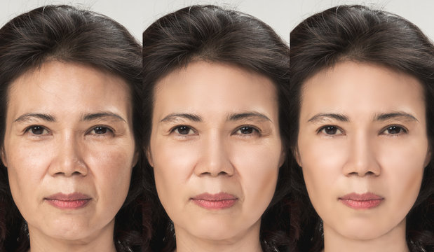 Anti Aging process, Asian woman face skin with anti-aging procedures, rejuvenation, lifting, tightening of facial skin, restoration of youthful skin anti-wrinkle. Old and young concept.