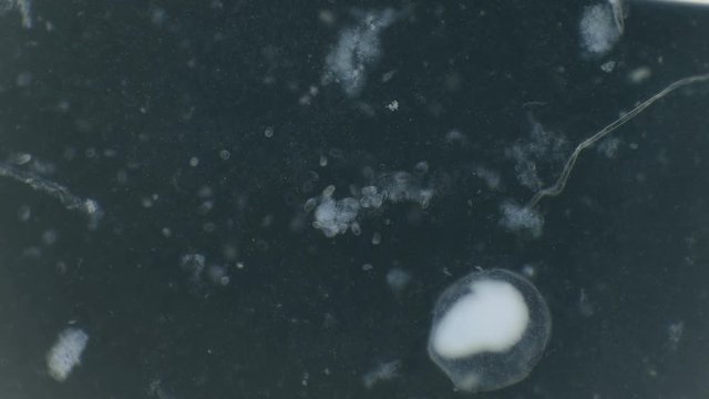 a large colony of protozoa moves under a microscope