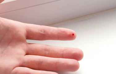 Cut on the finger of a man's hand. Blood flows.