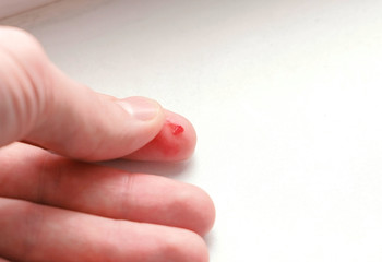 Cut on the finger of a man's hand. Blood flows.