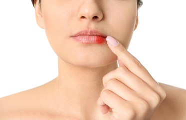 Woman with cold sore touching lips on white background, closeup