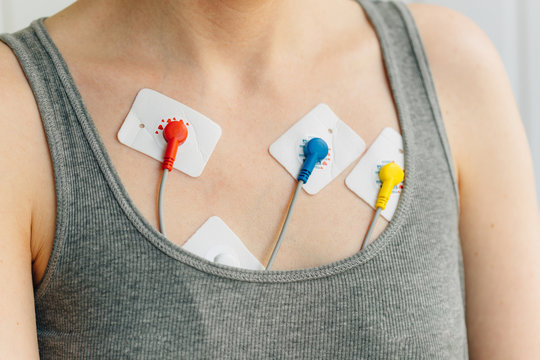 Woman wearing holter monitor device for daily monitoring of an electrocardiogram. Treatment of heart diseases