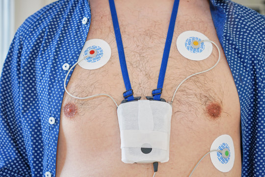 Man wearing 24 hrs electrocardiogram monitor device on his chest / heart investigation