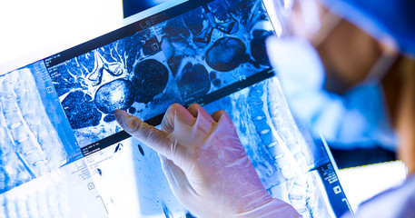 Two female women medical doctors looking at x-rays in a hospital.