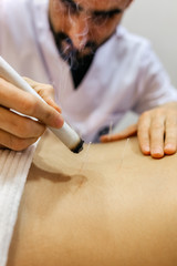 Woman being treated with acupuncture and moxibustion treatments