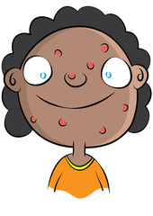 cute black girl with acne problem