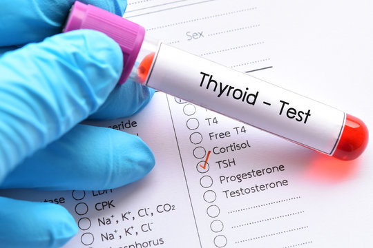 Blood sample for thyroid hormone test