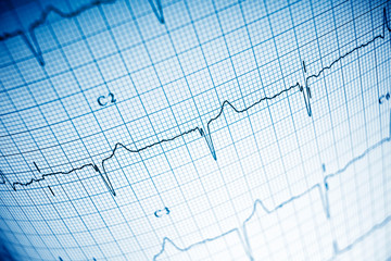 Electrocardiogram close up