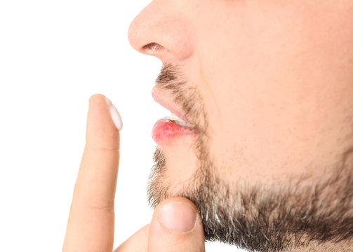 Man Applying Cream Onto Lips On White Background, Closeup