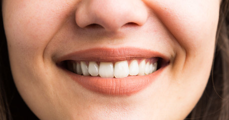 Close-up of female teeth smile.
