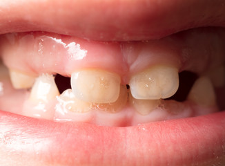 The teeth of the boy as a background