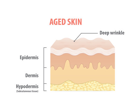 Aged skin diagram illustration vector on white background. Medical concept.