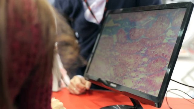 Projection of a picture from a microscope to a monitor