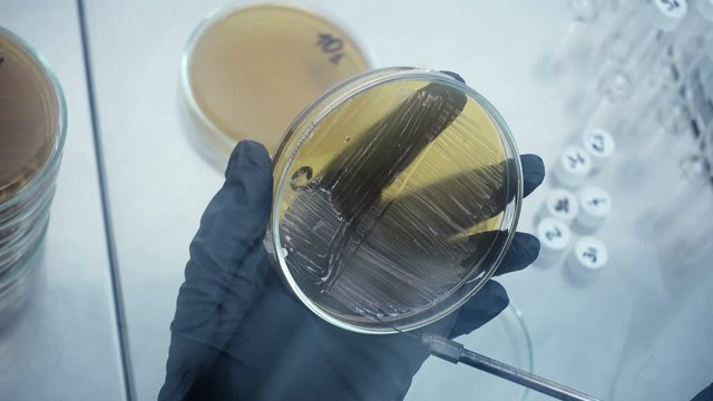 Close-up of a sample selection. Microbiological laboratory work. The real work in labortory.