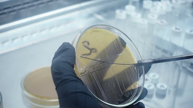 Close-up of a sample selection. Microbiological laboratory work. The real work in labortory.
