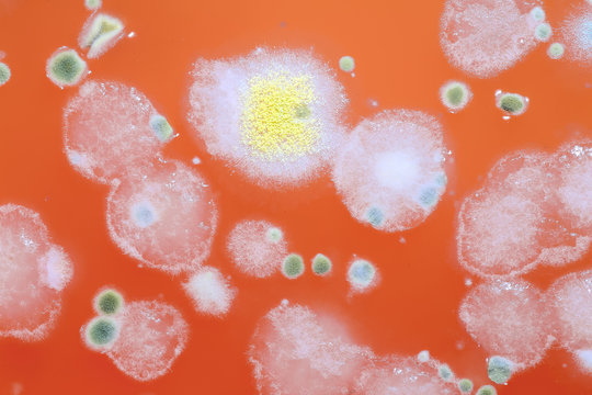 Mold in a liquid background close. Reproduction of microorganisms