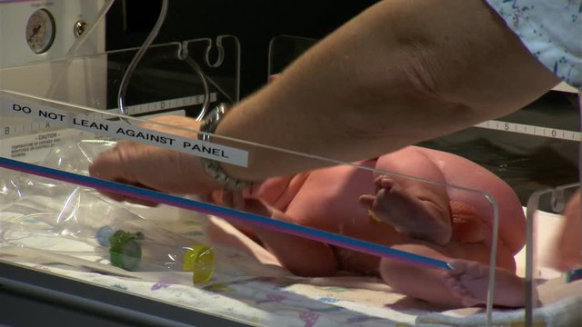 Nurse applying ointment to newborn baby boy's eyes 
