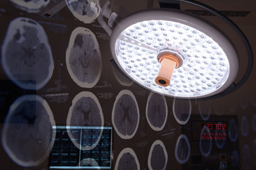 images from a computerized tomography of the brain and surgical lamps in operation room