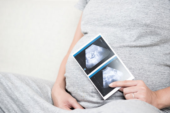 Soft focus and blurry of happy pregnant woman sitting on sofa at home holding and showing ultrasound scan photos.