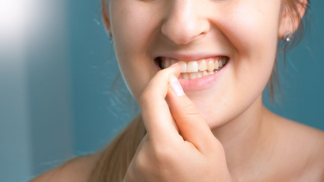 Closeup image of young woman taking out stuck food from teeth
