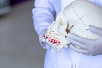  Study cast of Diagnostic cast and dental gypsum models in dental laboratory.